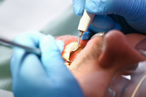 Best Urgent Care for Lost Fillings or Crowns in Ledgewood, NJ