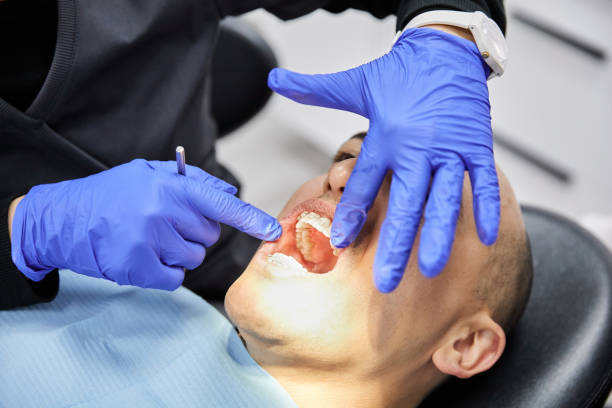 Best Emergency Wisdom Teeth Removal in Ledgewood, NJ