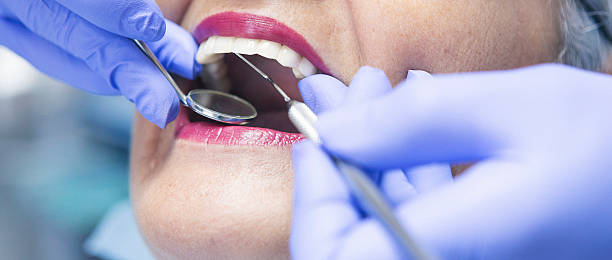 Best Emergency Treatment for Dental Infections or Abscesses in Ledgewood, NJ